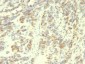  Transglutaminase II (TGM2) Antibody - With BSA and Azide